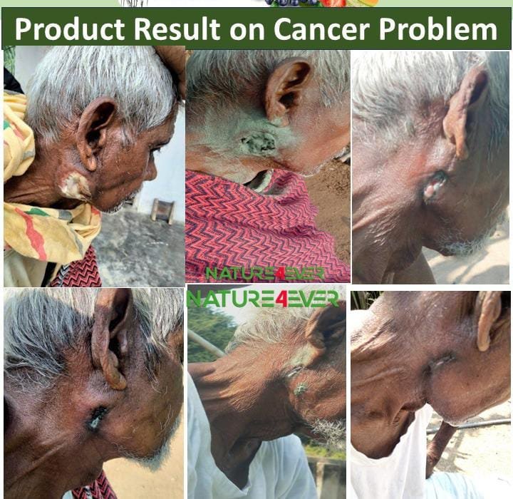 Biocellix price in India