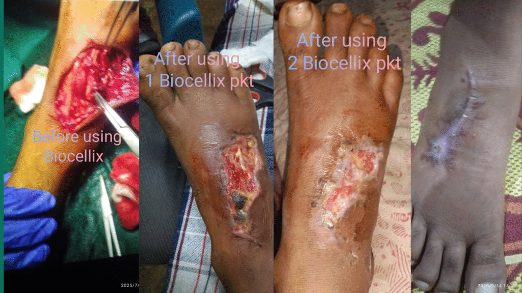 Add a subheading (13)